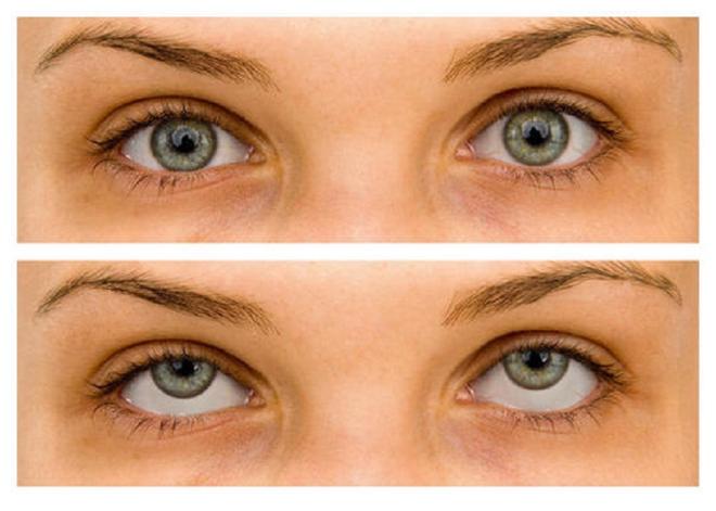 Rotar los ojos refresca la vista