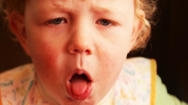 Evitar sequedad en el entorno 