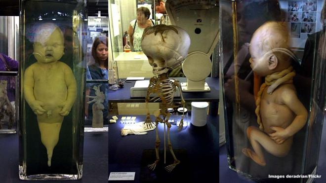 Berliner Medizinhistorisches Museum