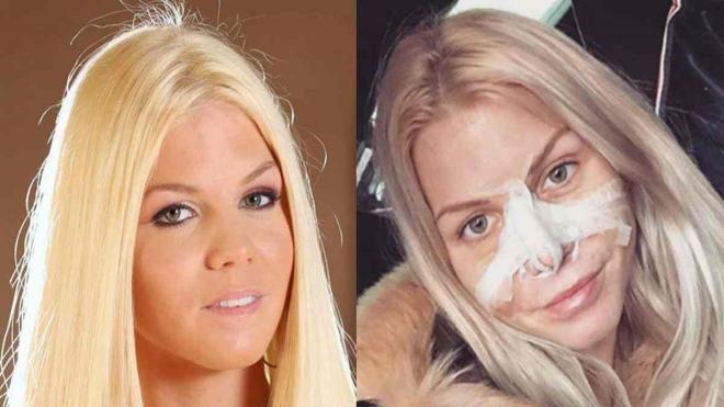 La chirurgie esth&eacute;tique