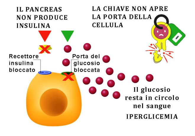 L'iperglicemia