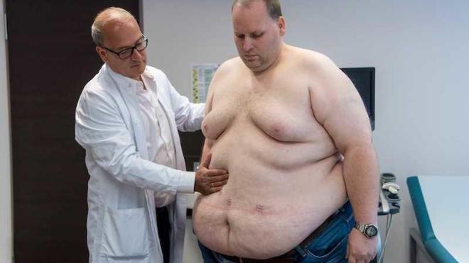 L'incidenza dell'obesit&agrave;