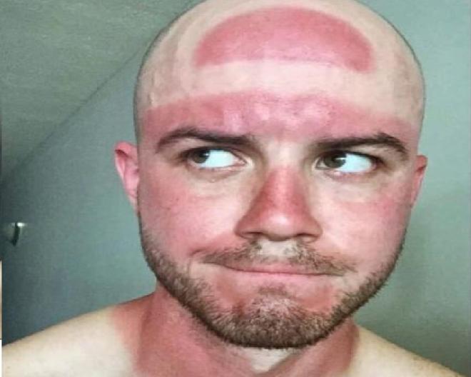 Esqueceu o bon&eacute;