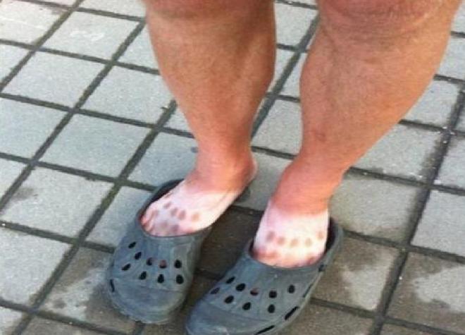 Sand&aacute;lia crocs