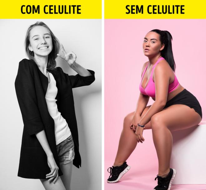 "Mulheres magras n&atilde;o t&ecirc;m celulite"