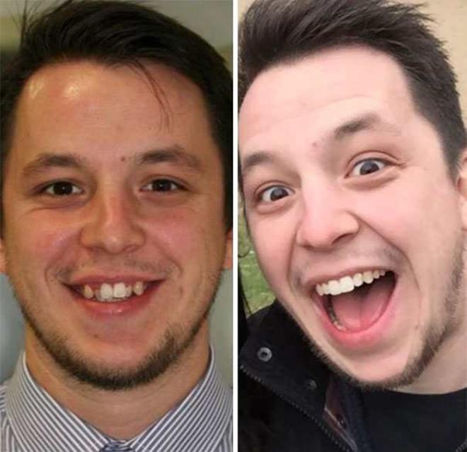 Dentes nos lugares certos