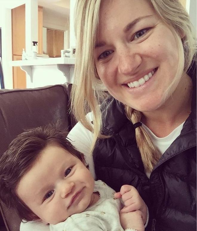 Sem problemas com a calv&iacute;cie 