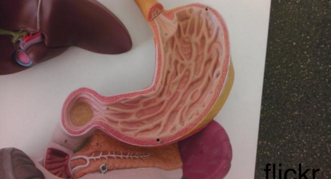 Impaired digestive system 