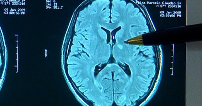 Estimulante para o c&eacute;rebro.