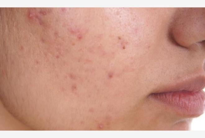 I benefici sulla pelle