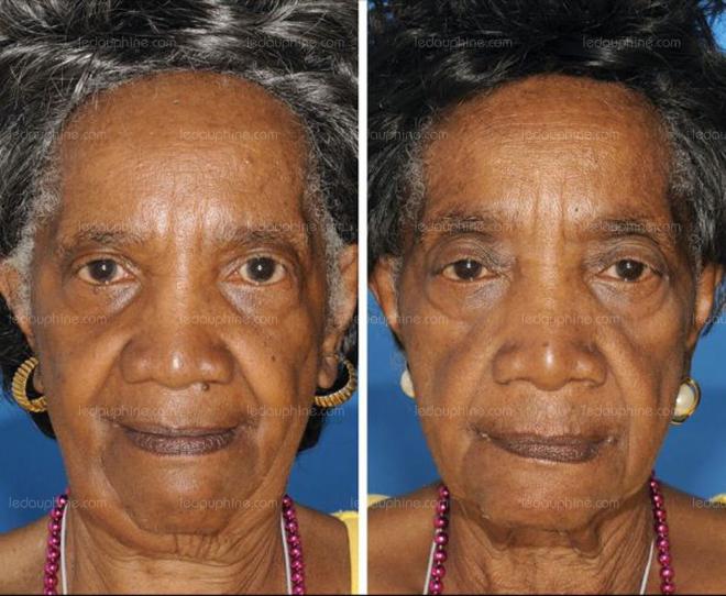 Jumelles num&eacute;ro 4