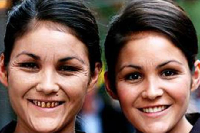 Jumelles num&eacute;ro trois