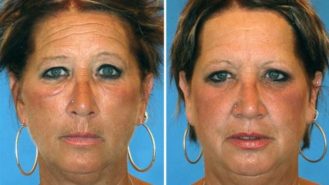 Jumelles num&eacute;ro 1