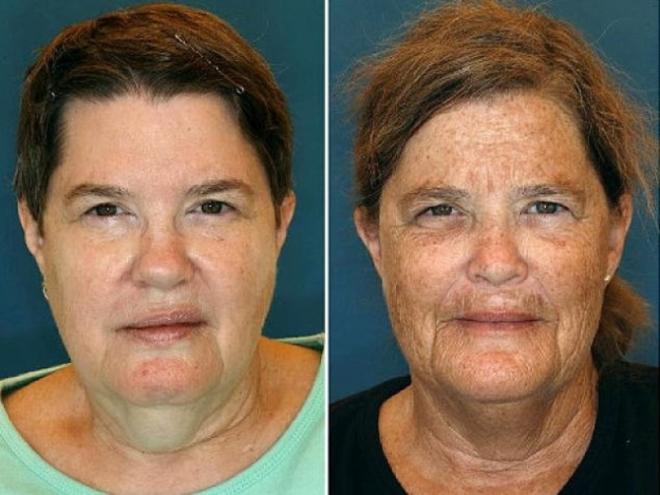 Jumelles num&eacute;ro deux