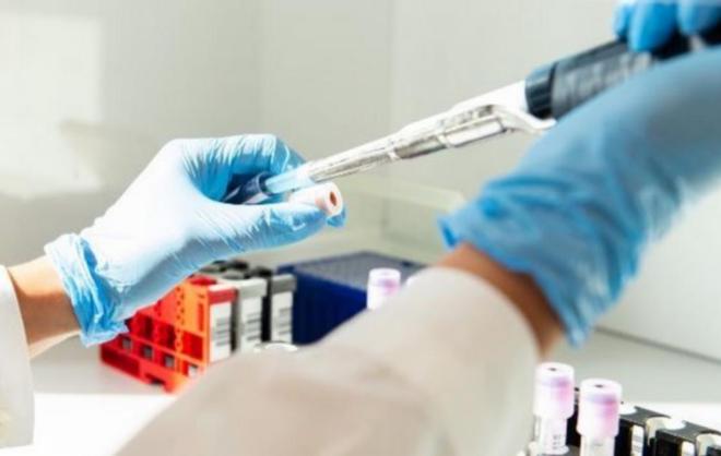 Il Coronavirus &egrave; stato creato in laboratorio