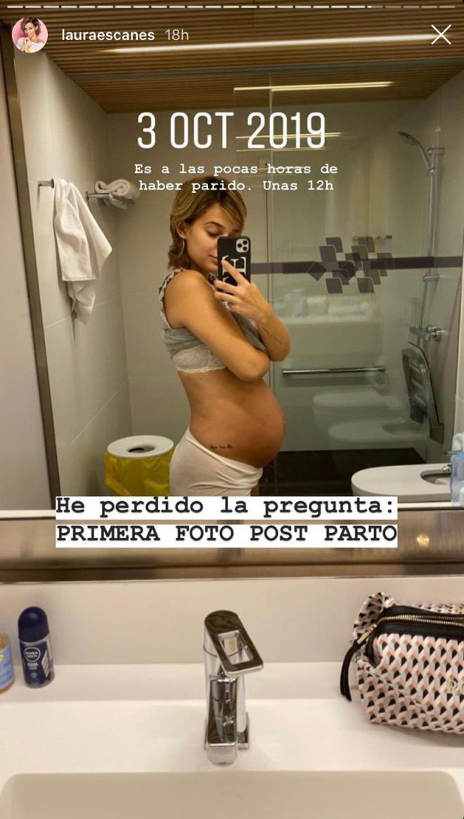 Primera foto postparto