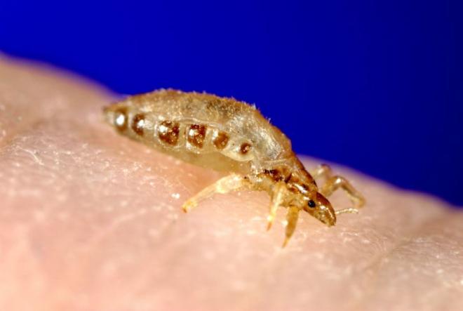 Tifo epid&ecirc;mico (exantem&aacute;tico)