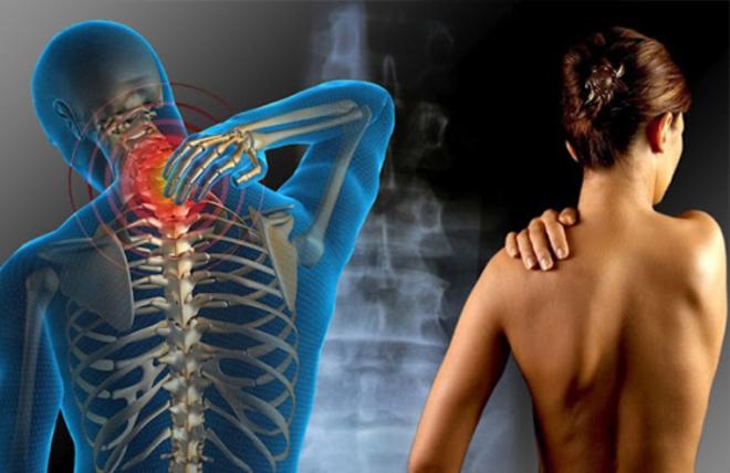 Fibromialgia o Fatiga Cr&oacute;nica