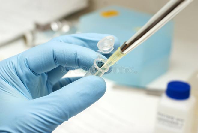Produzione di vaccini mediante le Biotecnologie