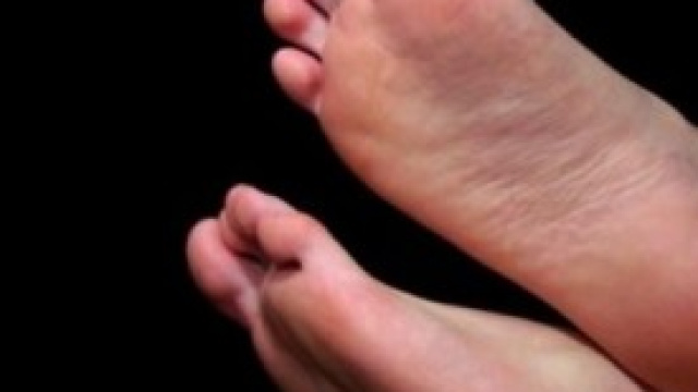 La sudorazione dei piedi non &egrave; pi&ugrave; un problema