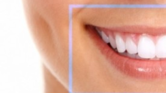 Le soluzioni per la salute dei denti