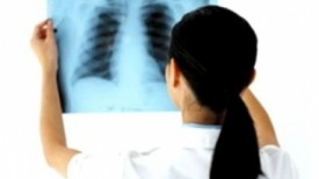 tumore al polmone svelato con test del sangue