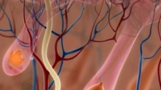 Rigenerazione Cellulare (follicolo non atrofico)