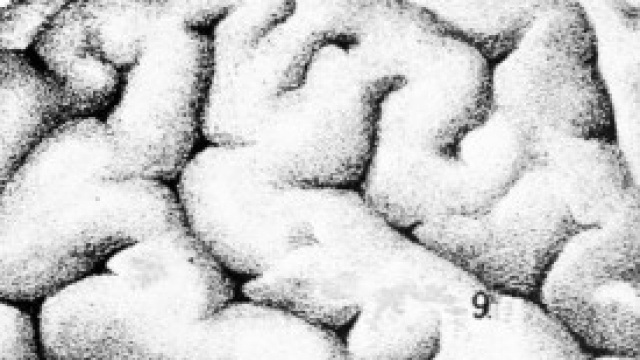 Una sezione del cervello umano