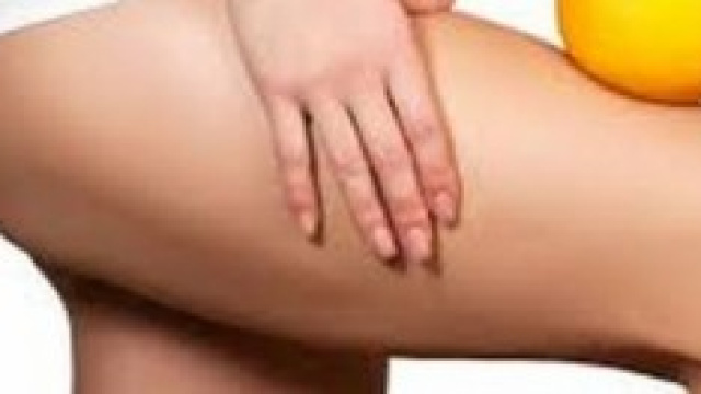Contro la cellulite arriva l&rsquo; Endo Lipo Laser