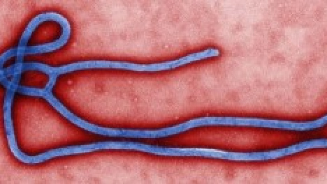 Virus Ebola 2014 News: a Roma falso allarme