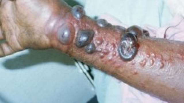 E' seria la minaccia del virus