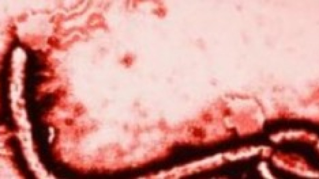 Virus Ebola: Barack Obama nomina supercommissario