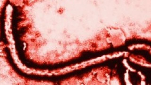 Virus Ebola al microscopio elettronico