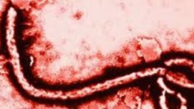 Virus Ebola 2014: contagio e sintomi