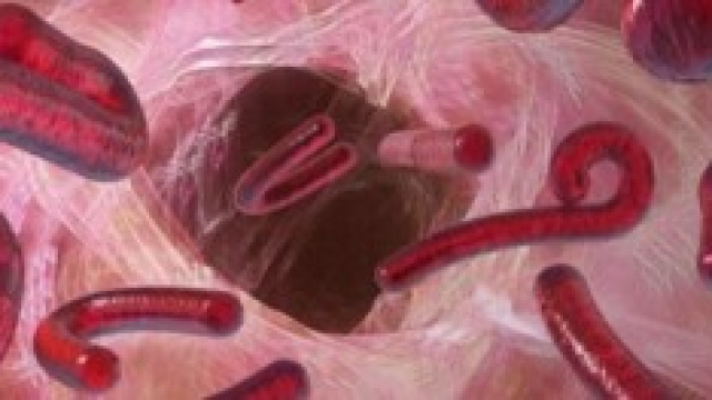 Virus Ebola, tutte le info e rischi in Italia