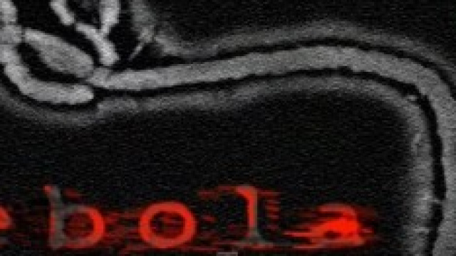 Ebola, in Italia &egrave; psicosi: due episodi a Roma