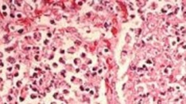 Legionella: sei casi nel milanese