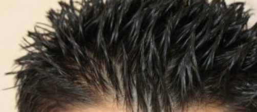 Causas y soluciones para el pelo graso.