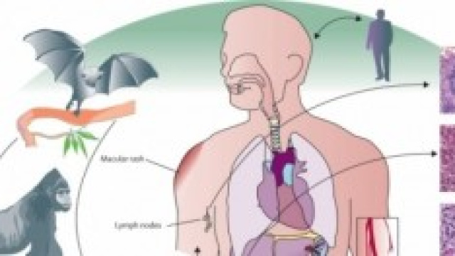 Virus Ebola 2041 news su vaccino, contagio sintomi