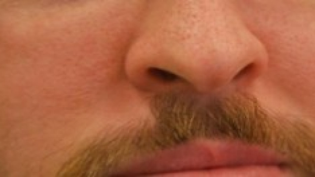 Apparato respiratorio, patologie 