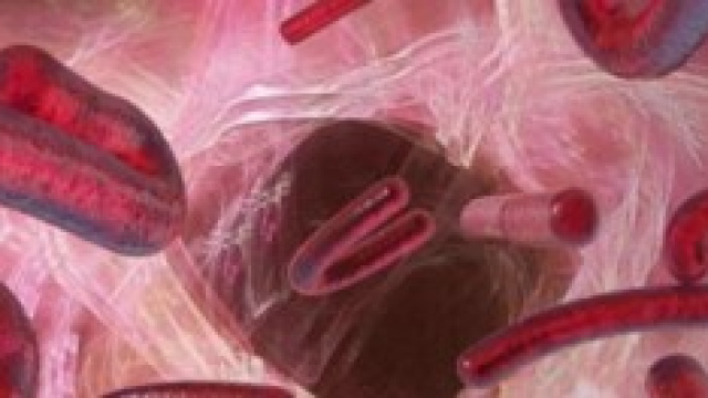 Il virus Ebola che sta terrorizzando il mondo.