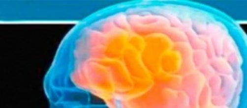 Imagen de una radiograf&iacute;a cerebral.