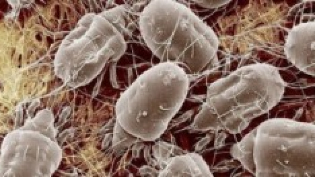 Oggetti comuni infestati da batteri