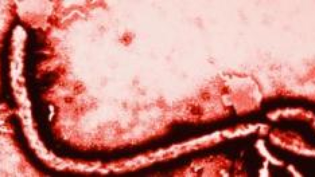 ebola, ultime news sul medico italiano 