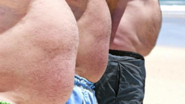 Corte Europea: obesit&agrave; grave &egrave; handicap