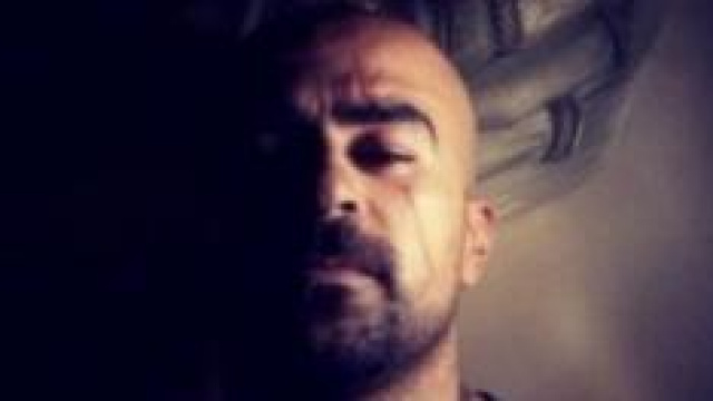 Il volto di Suleiman con la cicatrice sull'occhio