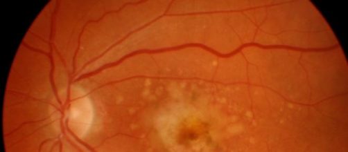 C&eacute;lulas madre, posibles regeneradoras de tejidos