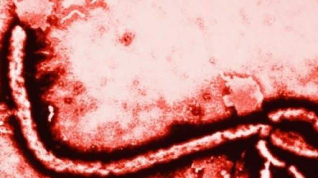 ebola, il medico contagiato migliora