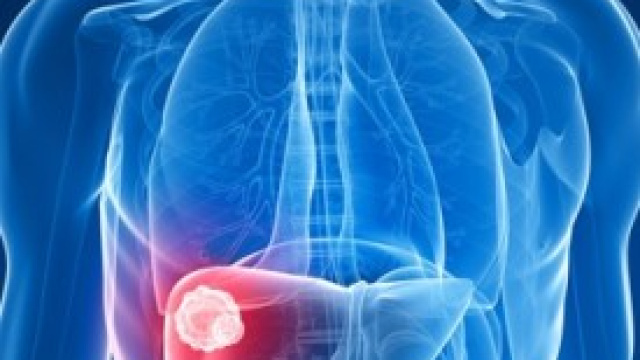 Fegato, disintossicarsi mangiando sano