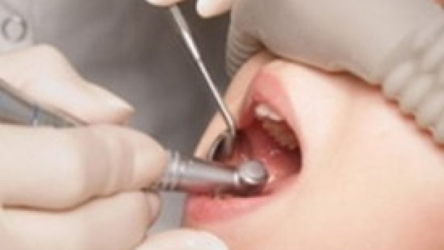 La sedazione cosciente dal dentista: come funziona